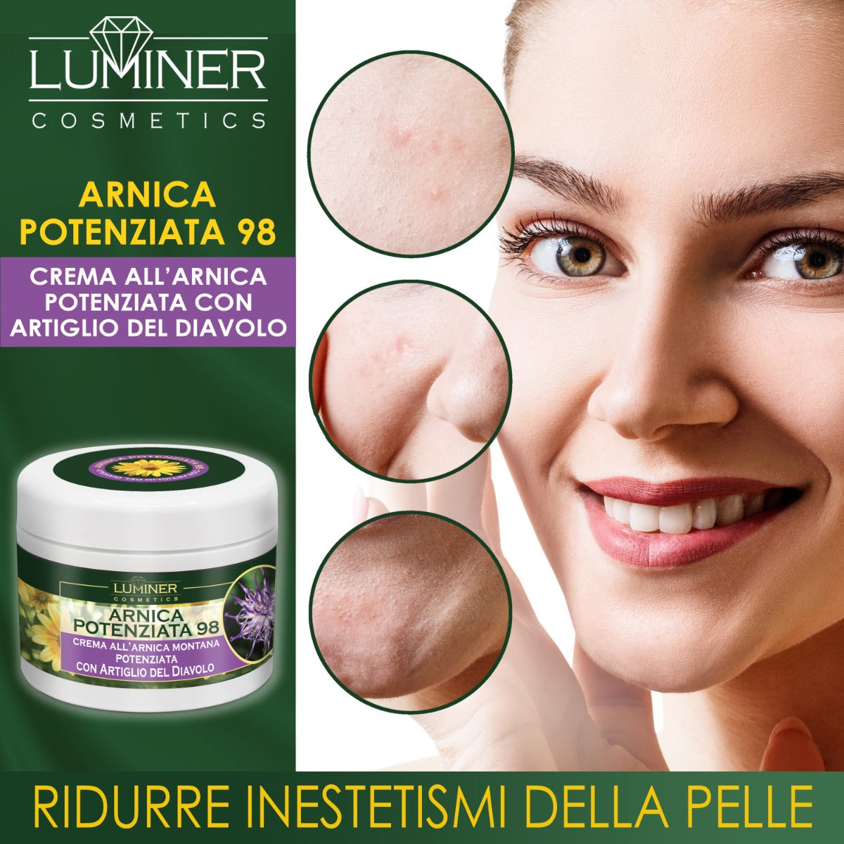 Arnica Potenziata